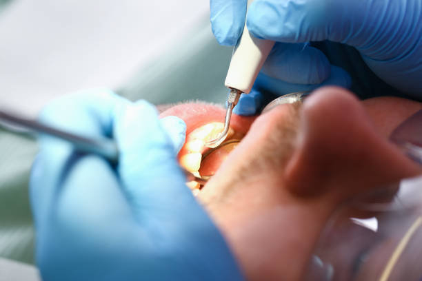 Best Tooth Pain Emergency Relief  in Marysville, OH